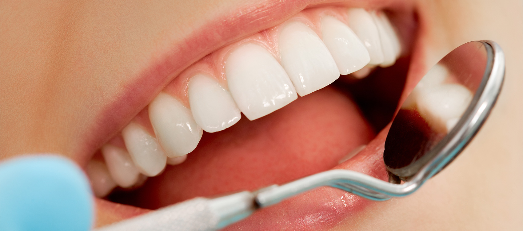 Dr Stajčić - Estetska restaurativna stomatologija.