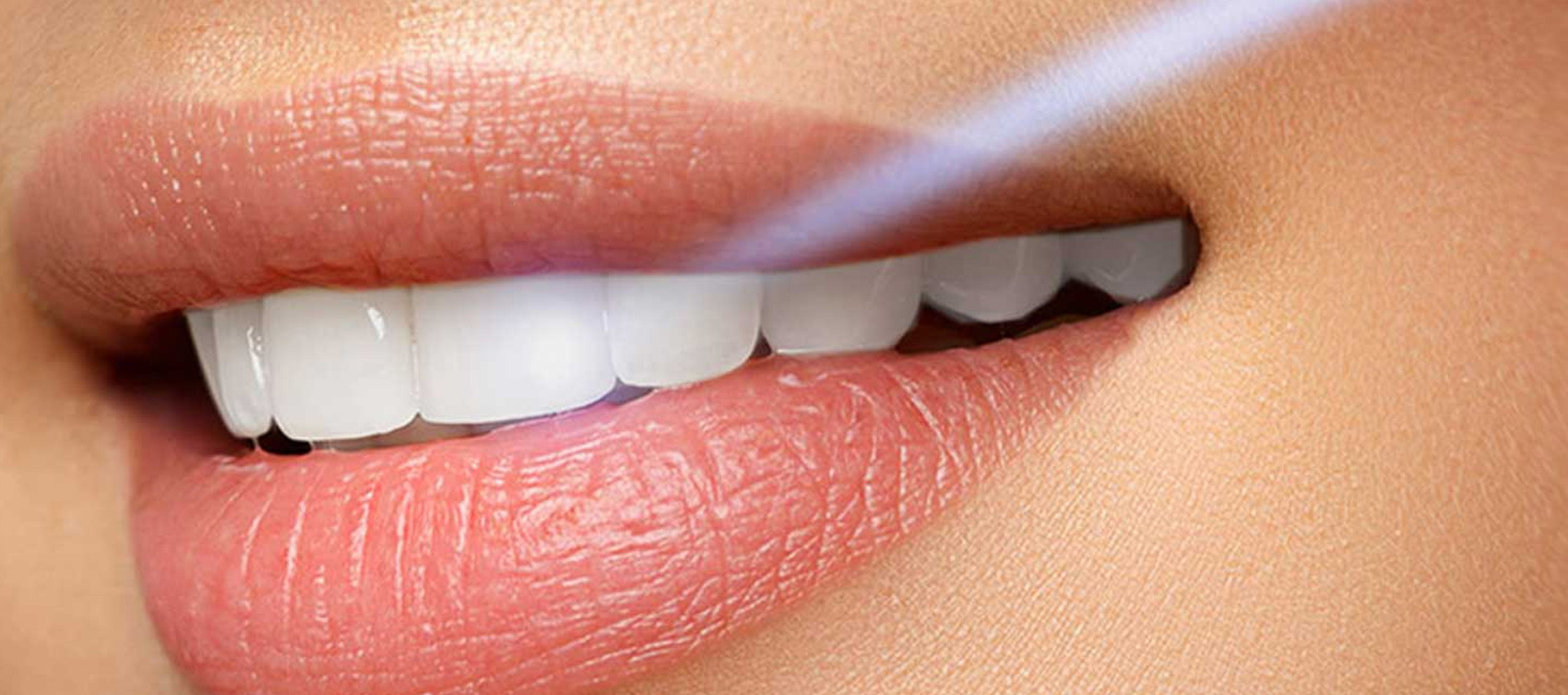 Dr Stajčić - laser u stomatologiji.